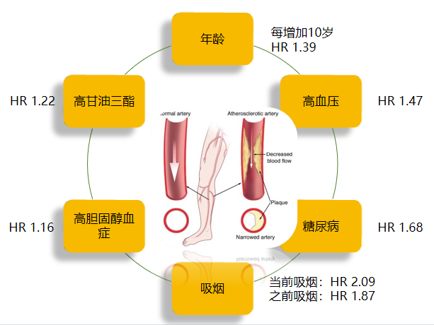 仁医直播间 | 静脉曲张、动脉硬化......这些下肢血管疾病不容忽视！