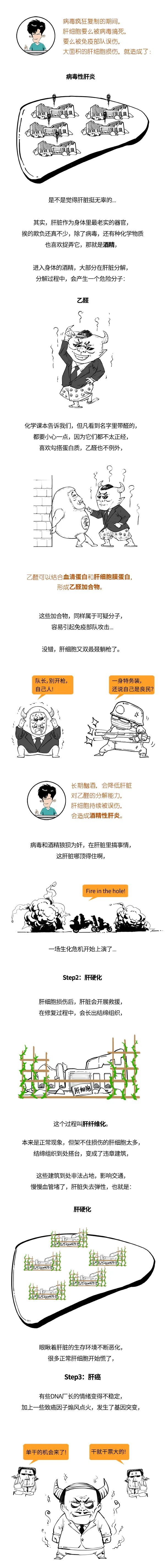 肝癌图解
