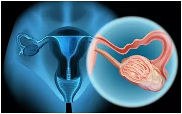 卵巢和宫颈