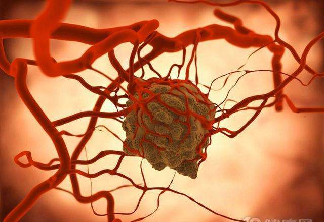 《自然》子刊：癌细胞转移前就把“黑手”伸进了淋巴管！科学家发现，黑色素瘤细胞会释放外泌体改造淋巴管，促进肿瘤转移丨科学大发现