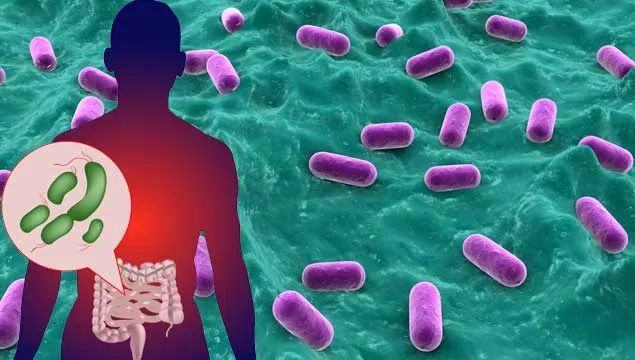 Science：癌症免疫疗法导致结肠炎，原因在于肠道菌群