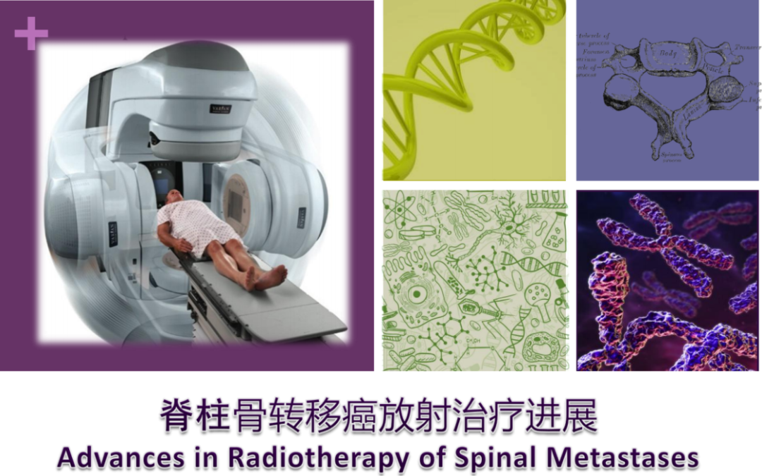 放疗基础-脊柱骨转移癌放射治疗【PPT分享附下载】